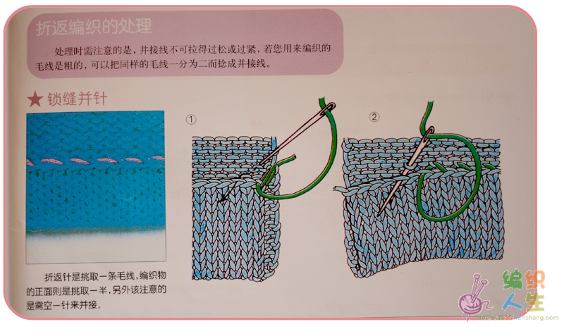 双螺纹缝针收针法及其应用解析